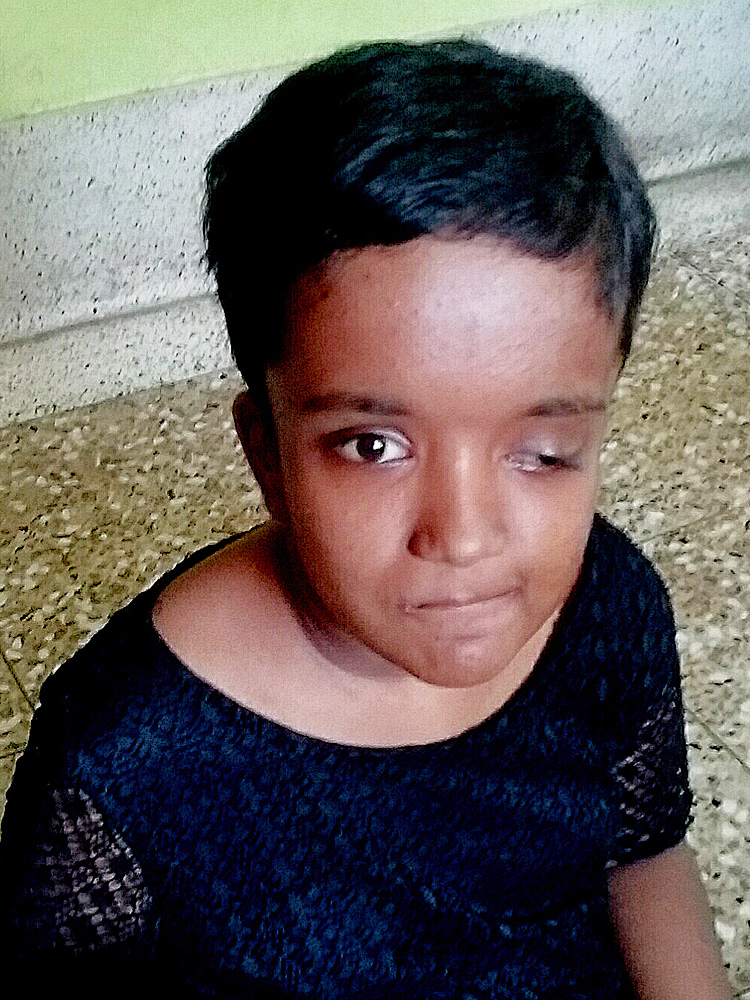 shuktara home for girls with disabilities - 2017 April - Moni's new haircut