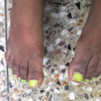 shuktara home for disabled girls - 2016 September - Feet with yellow nail varnish