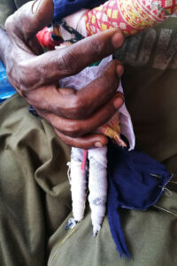 shuktara home for boys with disabilities - 2017 March - Sunil making his doll